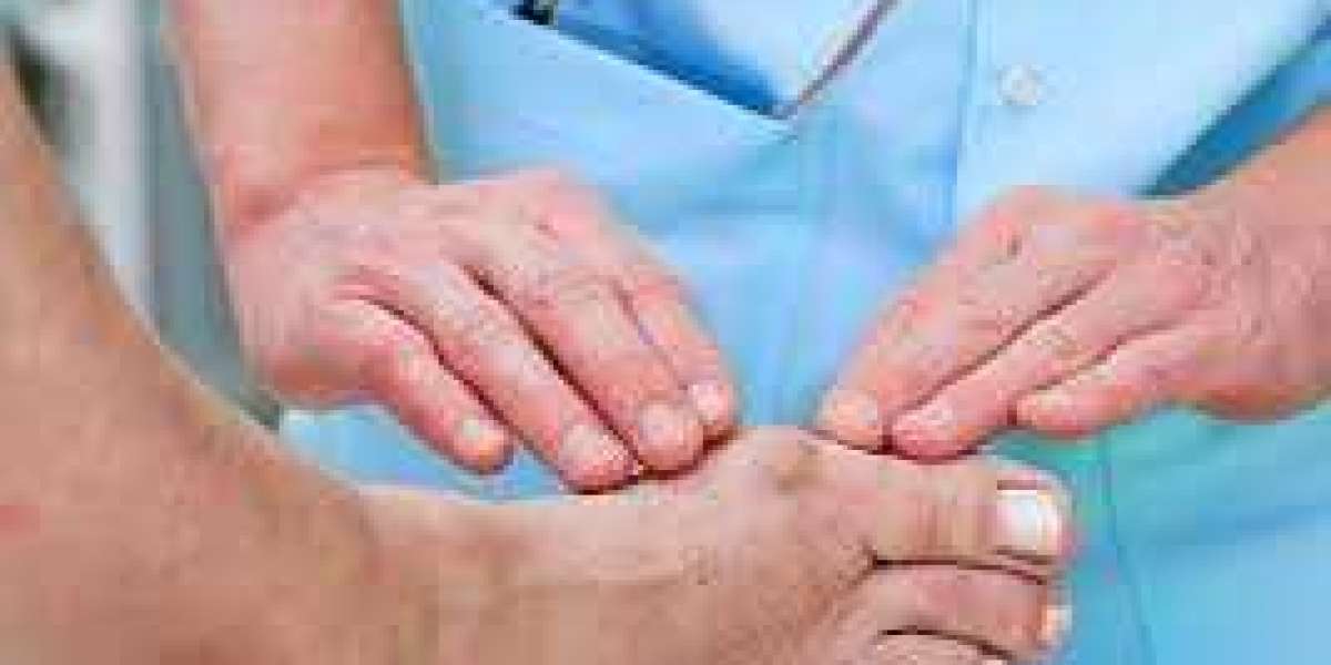 Diabetic Peripheral Neuropathy Treatment Market to Experience Significant Growth by 2033