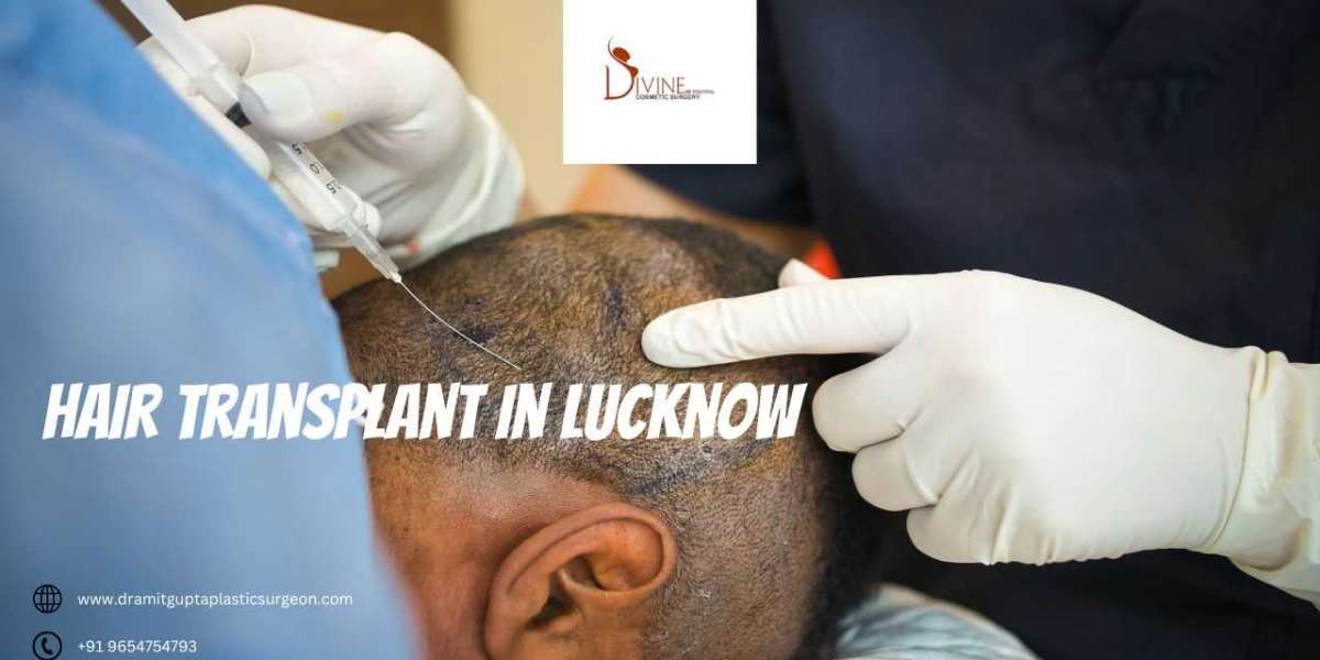 Divine Cosmetic Surgery: Your Ultimate Destination for Hair Transplant in Lucknow