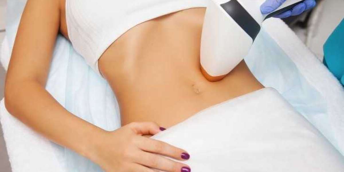 Deciphering CoolSculpting Pricing: Your Essential Guide