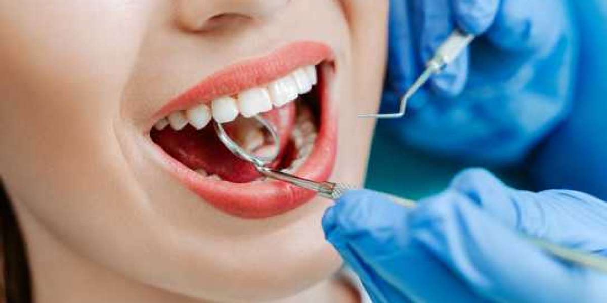 Dental Fillings in Breslau: Understanding, Options, and Care