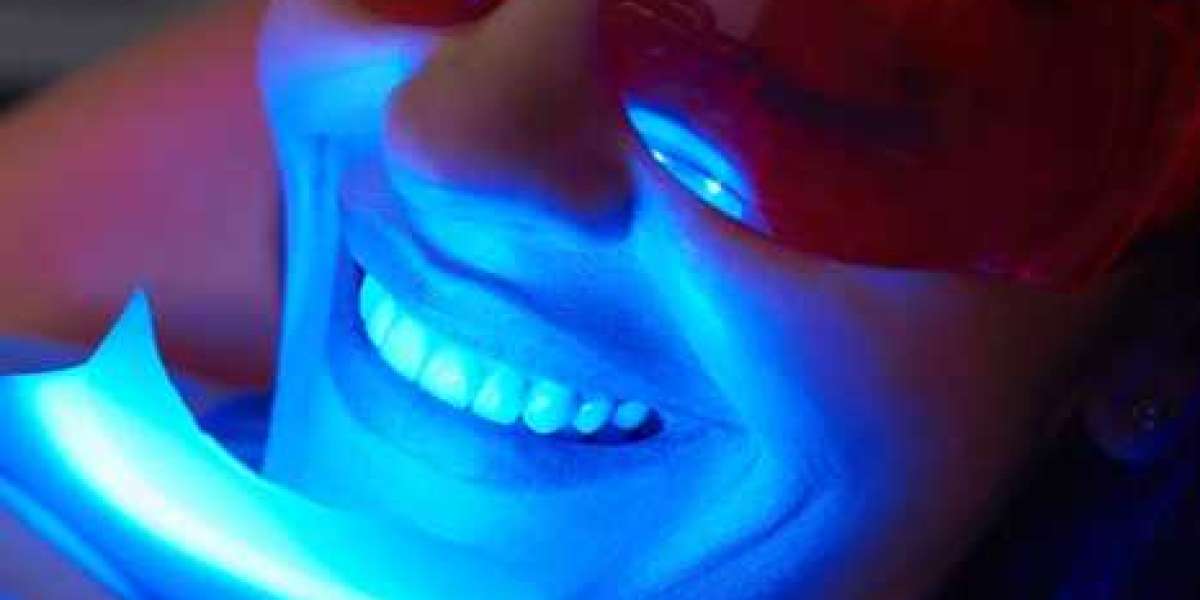 Unveiling the Brighter Smile: A Guide to Teeth Whitening in Portland