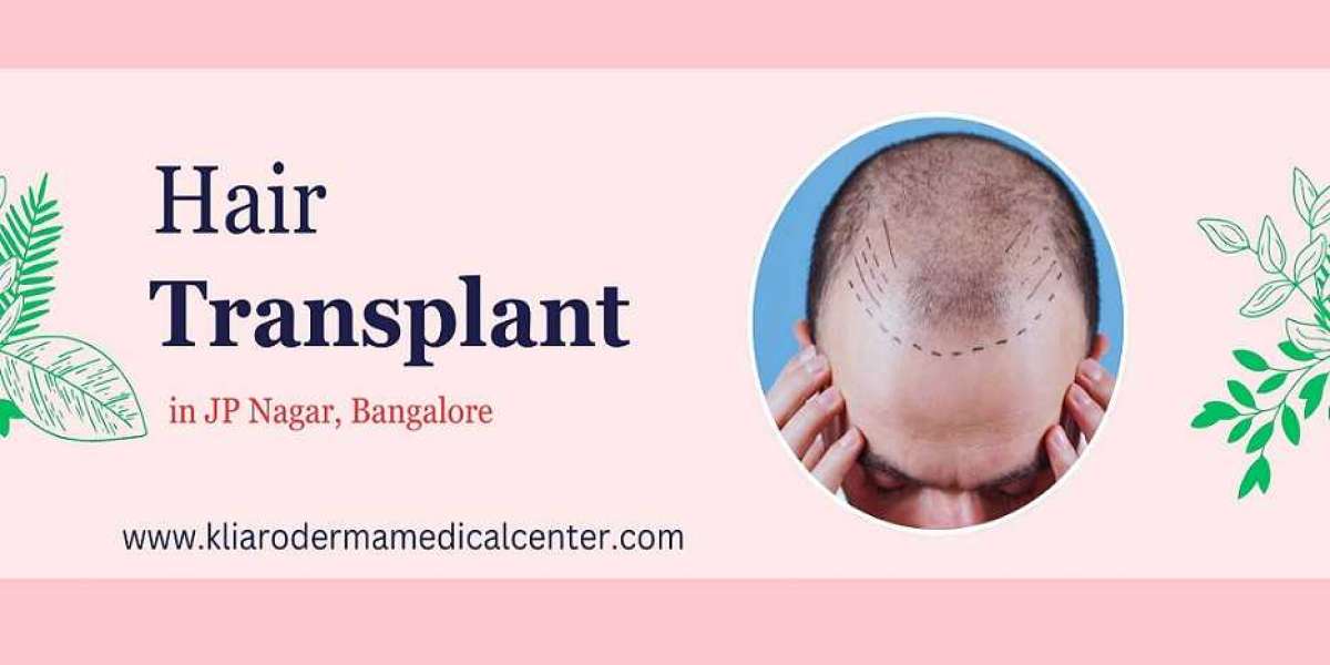 Is Hair Transplantation Right for You? Find Out Here