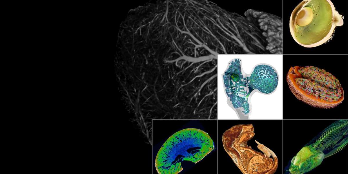 High Resolution 3D X-Ray Microscopy Market 2023 Overview, Growth Forecast, Demand and Development Research Report to 203