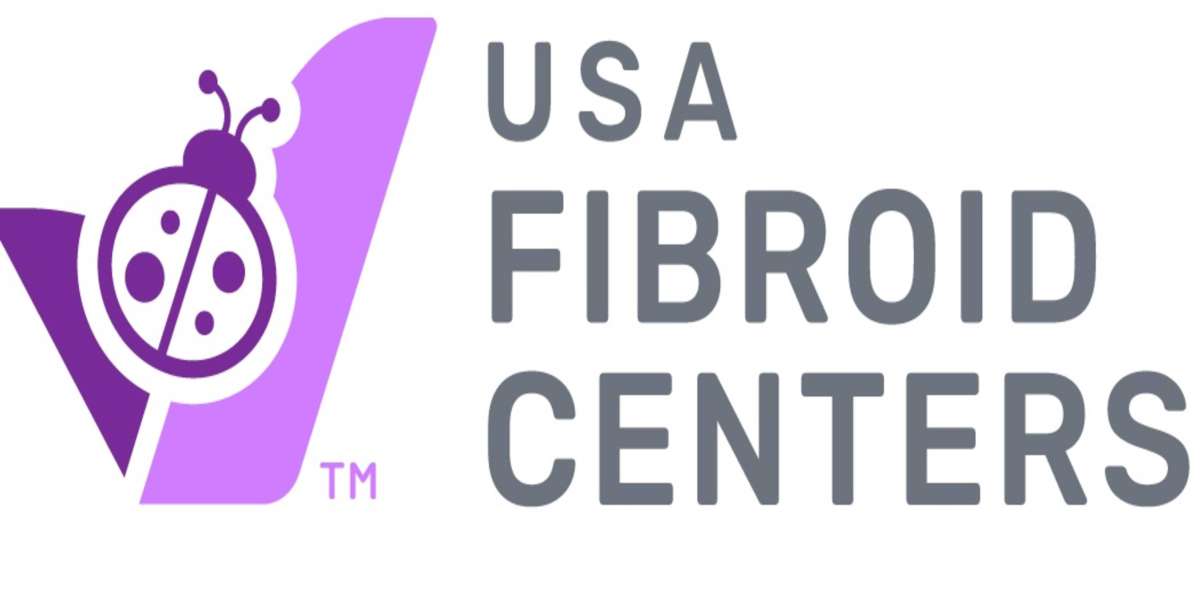 UFE Fibroid Treatment