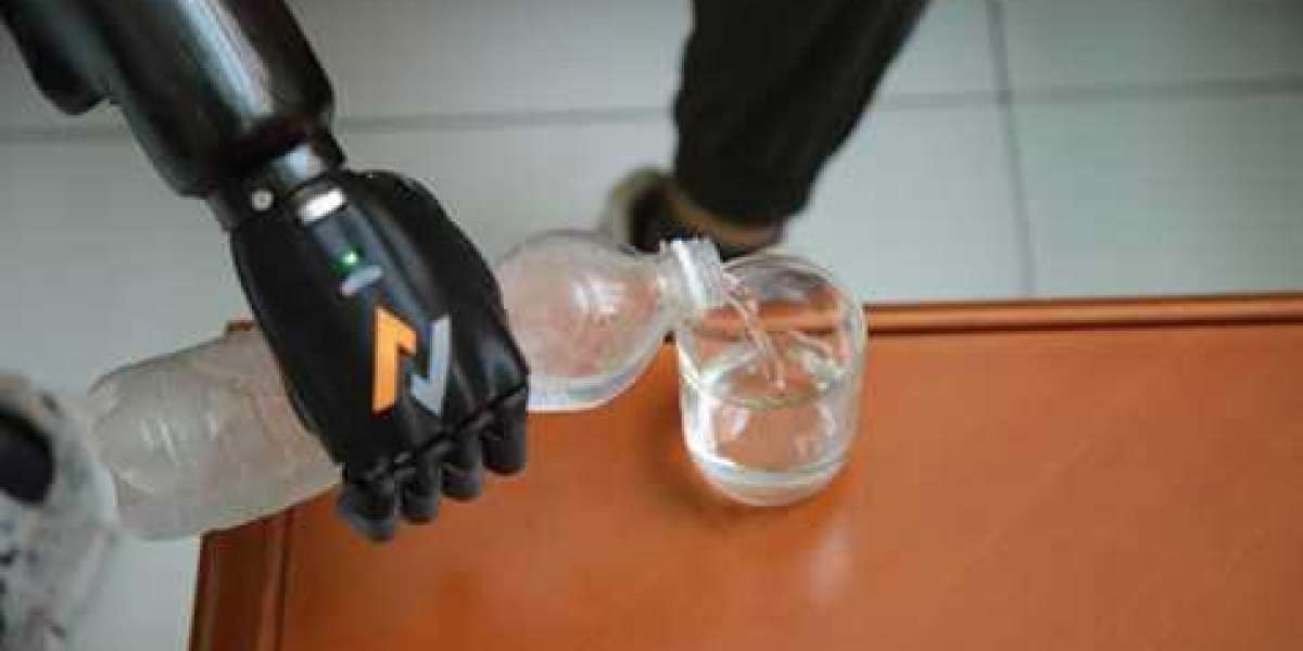 A New Era of Possibilities: Unlocking the Potential of Bionic Hands