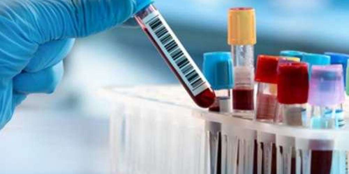 Diagnostic Lab Testing Market to Experience Significant Growth by 2033