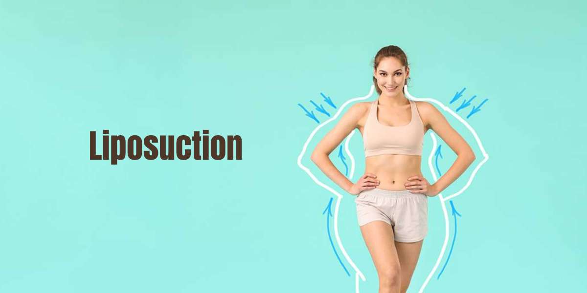 Liposuction: What It Is, Surgery, Recovery And Results