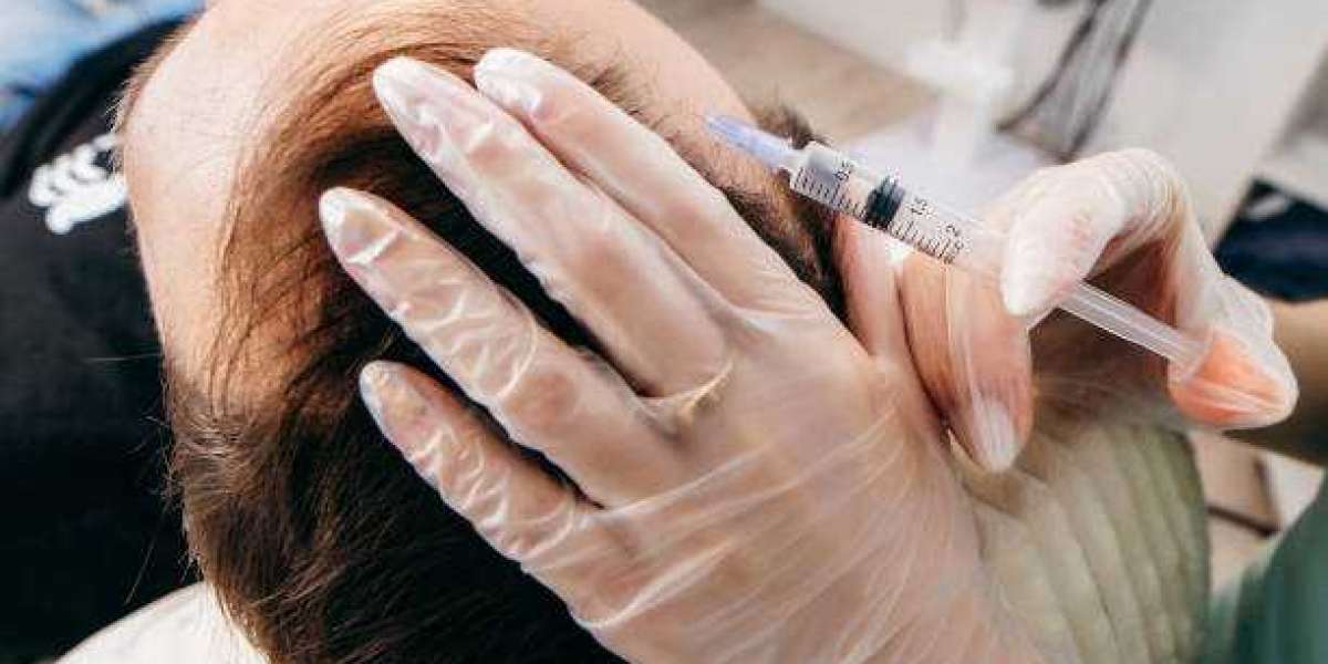 Regenera Activa in Riyadh: The Cutting-Edge Hair Treatment