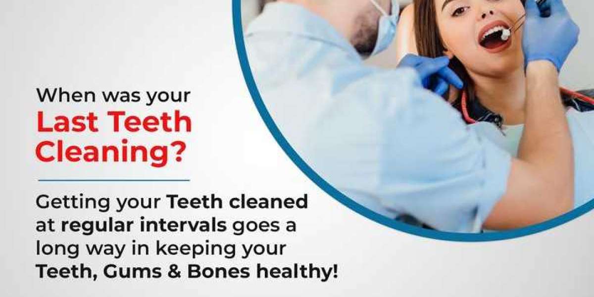 Teeth Cleaning Treatment in Kondapur - Capital Dental Care