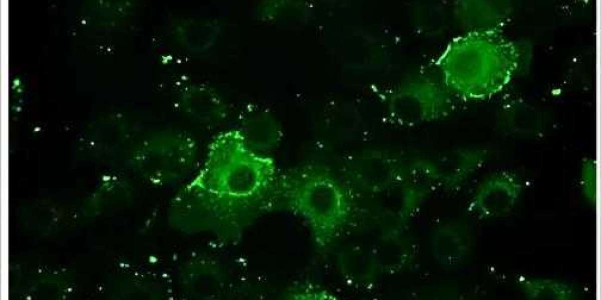 Immunofluorescence Assay Testing Services for Virology Research