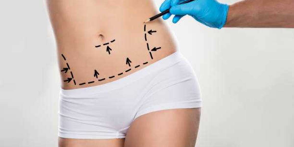 Dream Silhouette, Real Prices: Breast Liposuction Costs in Riyadh