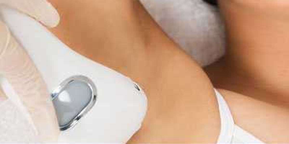 Why is Laser Hair Removal the Top Choice for Hair Removal?