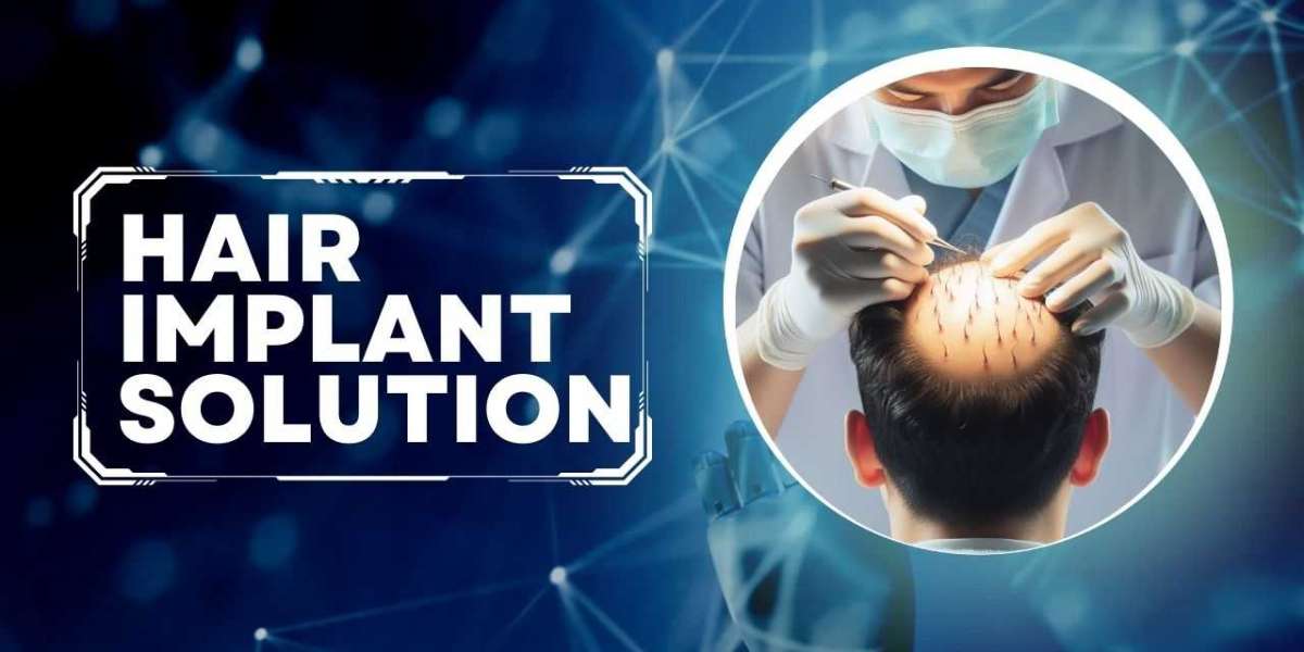 Exploring the Hair Implant Solution: A Complete Guide