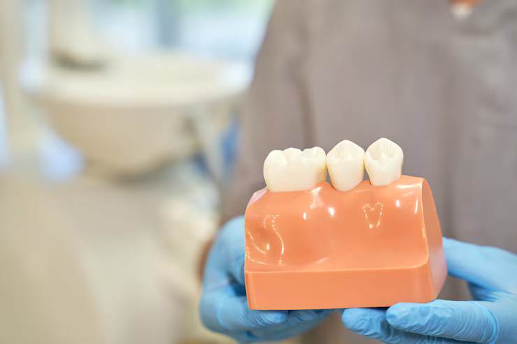 Understanding Dental Crowns and Their Uses