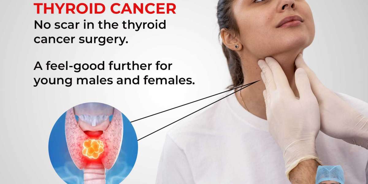 Thyroid Cancer in Treatment in Hyderabad | himayat nagar - Dr. Madhu Devarasetty