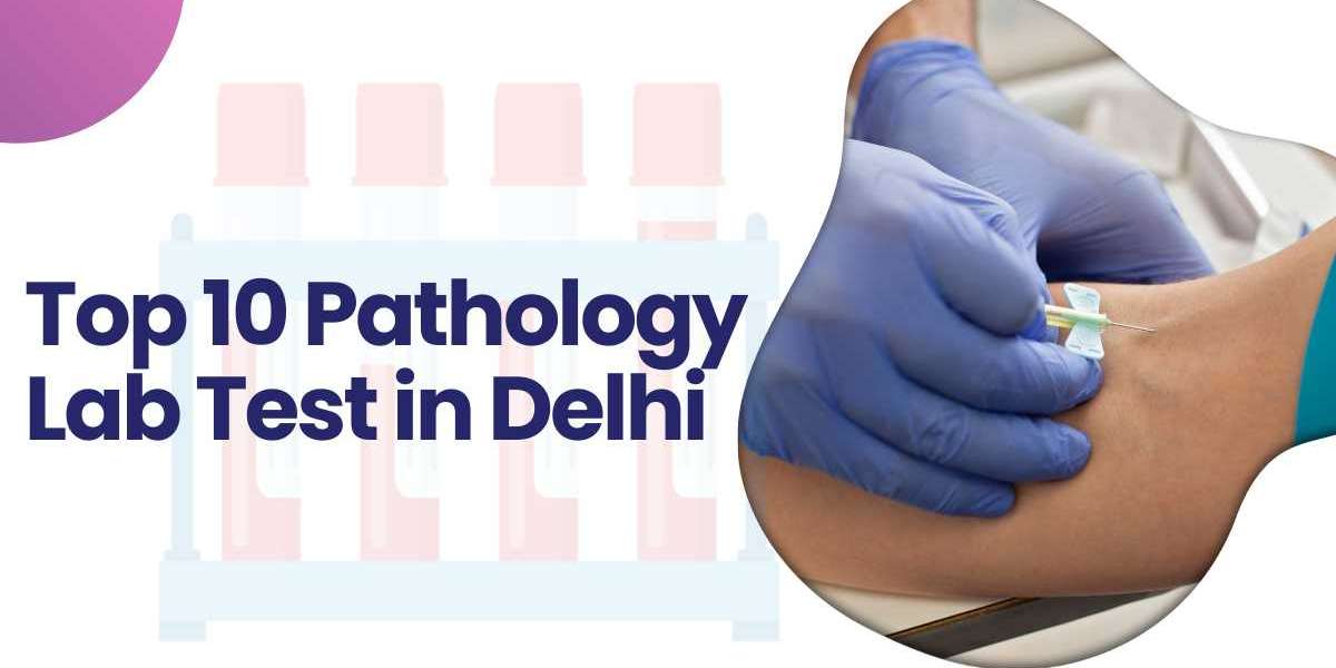 Top 10 Pathology Lab test in Delhi