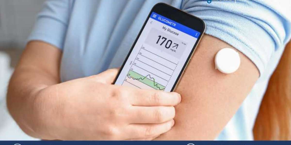 North America Continuous Glucose Monitoring Market Size, Share, Trends, Industry Growth & Analysis Report | 2032