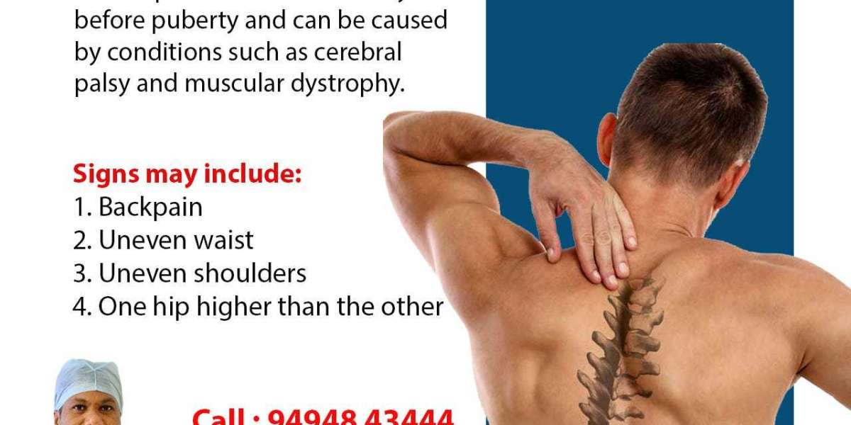 Scoliosis Treatment in Hyderabad- Dr. Suresh Cheekatla