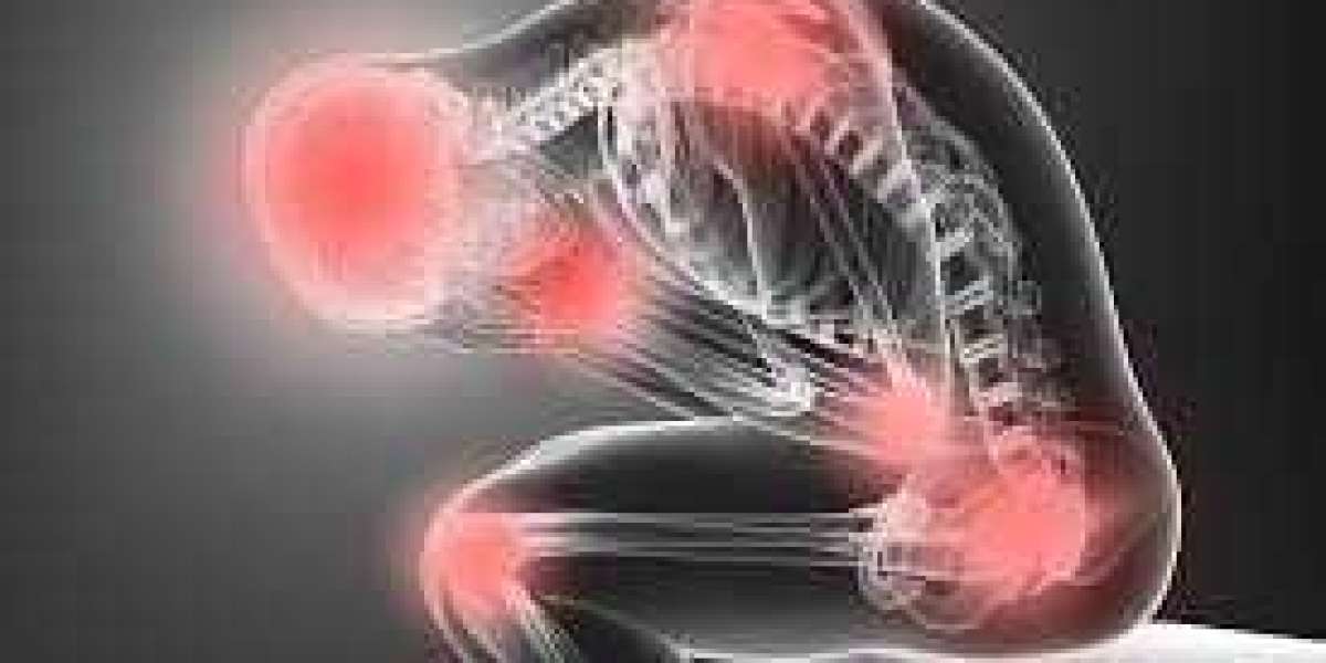 A Complete Guide to Understanding and Treating Neuropathic Pain