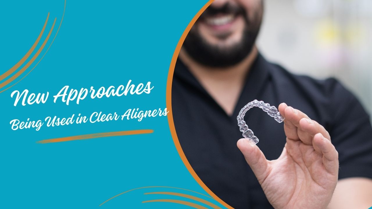 What are the 3 New Approaches Being Used in Clear Aligners?