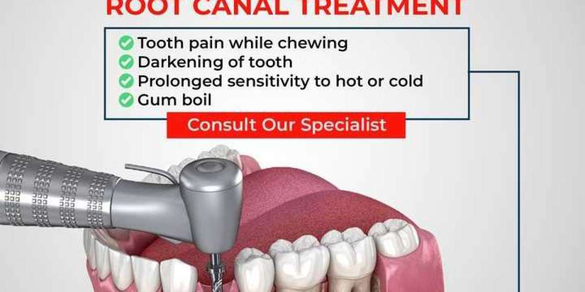 Root Canal Treatment in Kondapur - Capital Dental Care