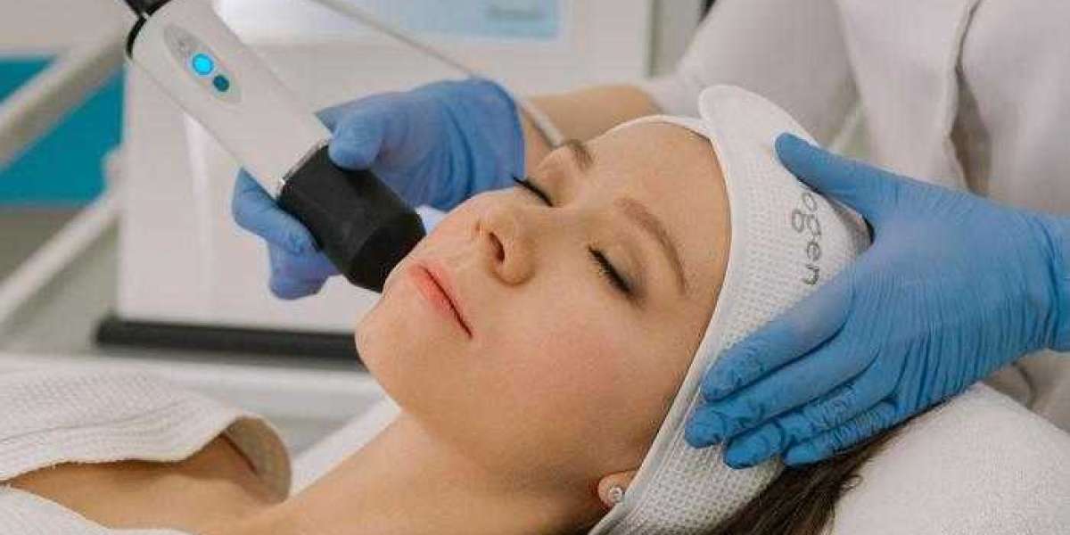 Say Goodbye to Dark Spots: The Science of Laser Skin Whitening Treatment