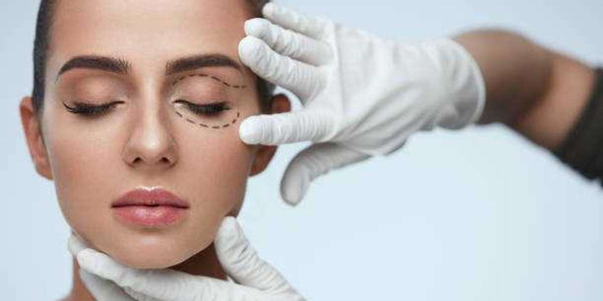 Transform Your Perspective: Eyelid Surgery in Riyadh Revealed