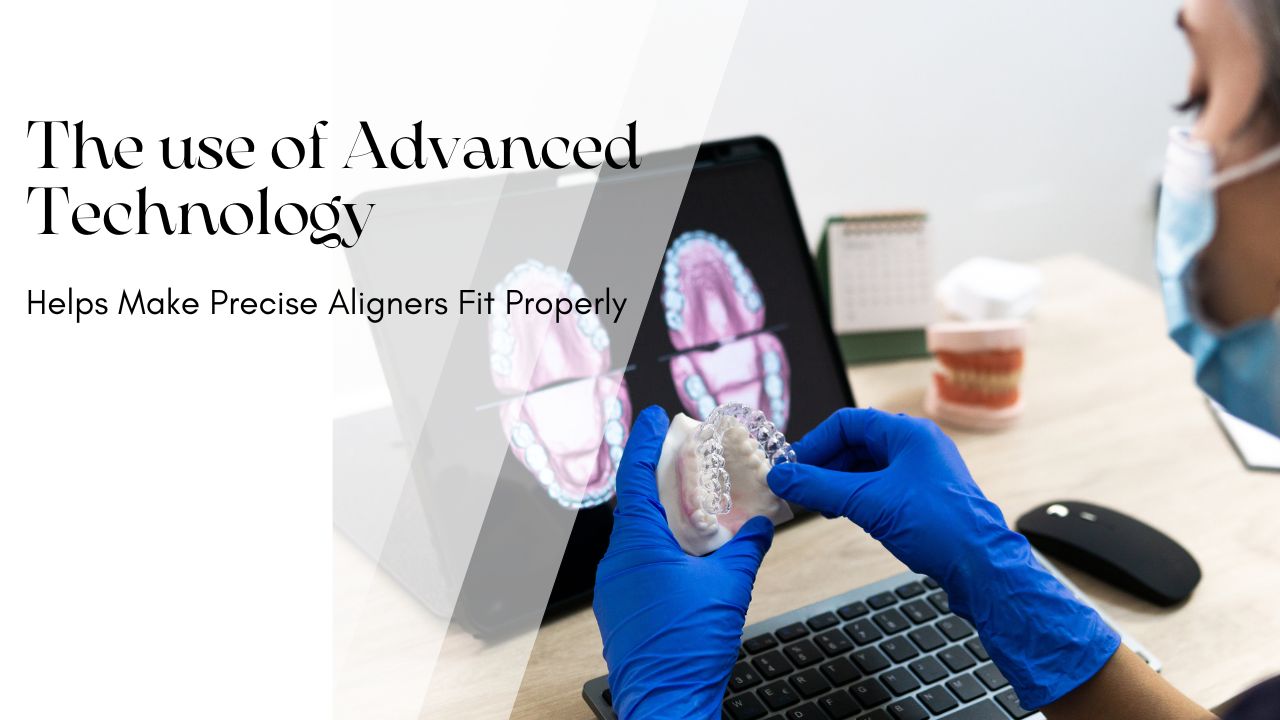 Use of Technology to Help Precise Clear Aligners Fit Properly