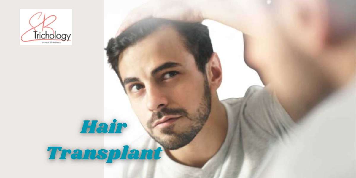 Do's & Don'ts After Hair Transplant Surgery